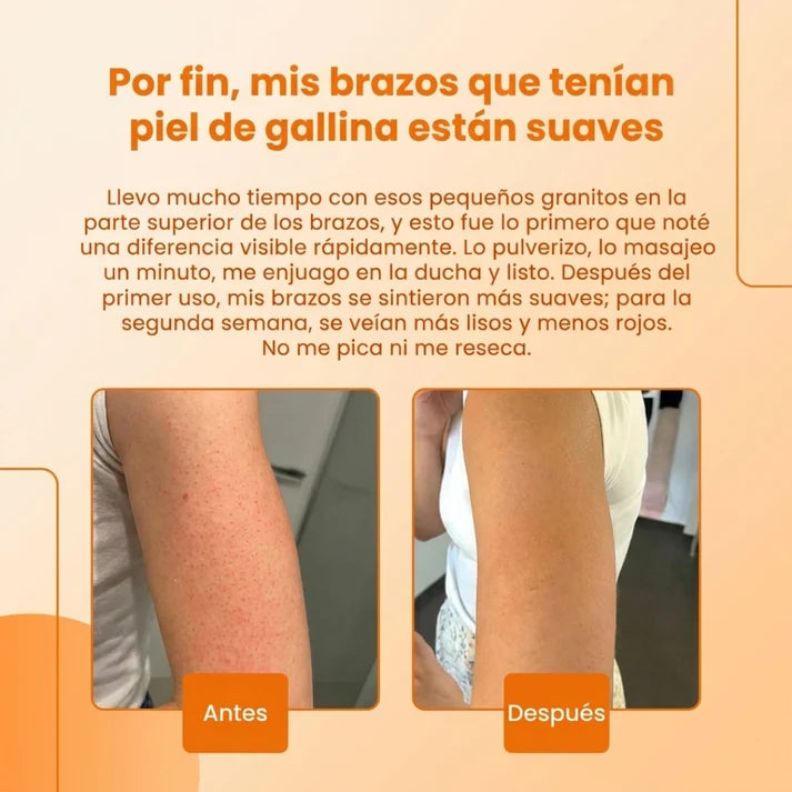 EvenGlow® I Exfoliante Corporal con Ácido Kójico y Cúrcuma revitalizante para la piel 200 ml