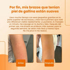 EvenGlow® I Exfoliante Corporal con Ácido Kójico y Cúrcuma revitalizante para la piel 200 ml