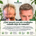 Farmavita I Alpha Capilar Pro®